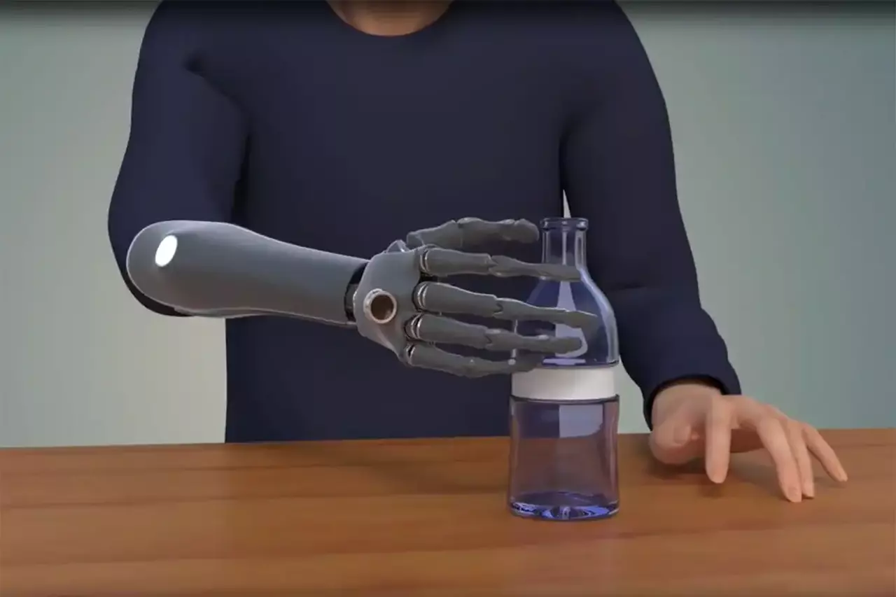 Bones, Muscles, and Nerves: The Bionic Hand that Becomes an Extension of the Body