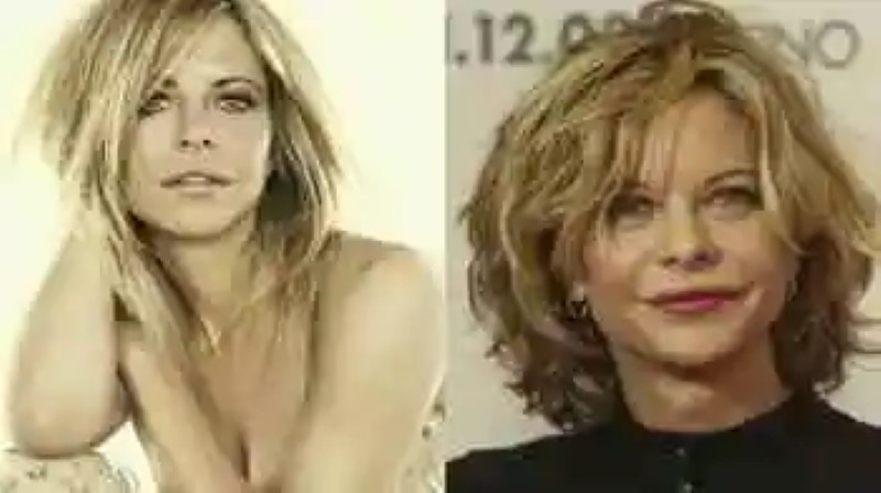 Mujeres famosas que se pasaron con el botox y así quedaron sus rostros