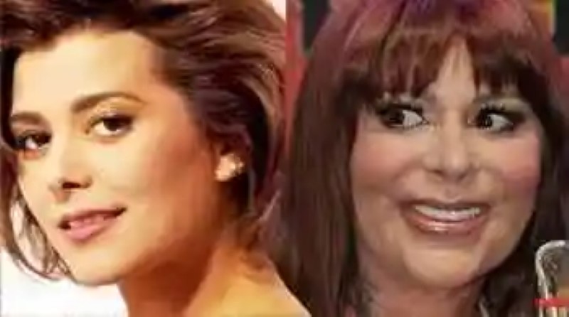 Mujeres famosas que se pasaron con el botox y así quedaron sus rostros