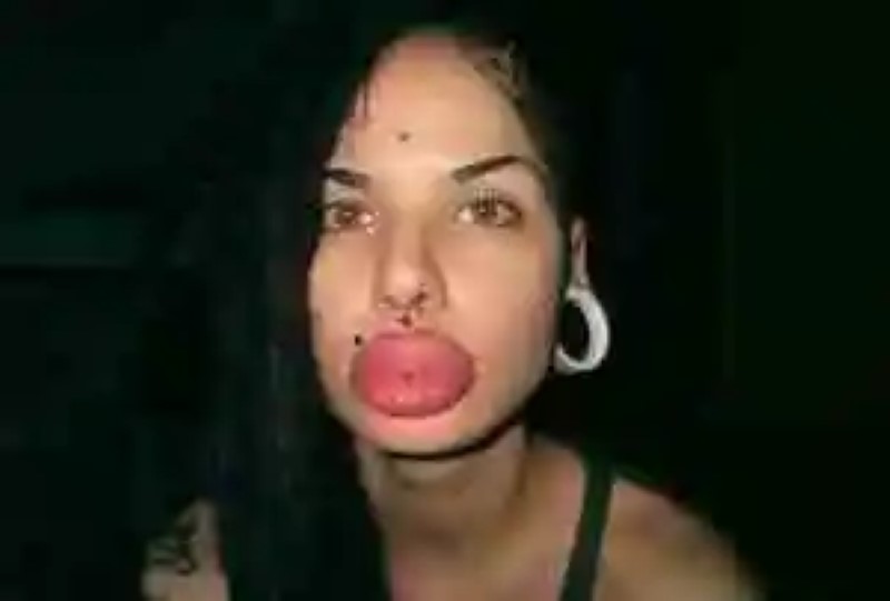 The woman with the world&#8217;s largest lips