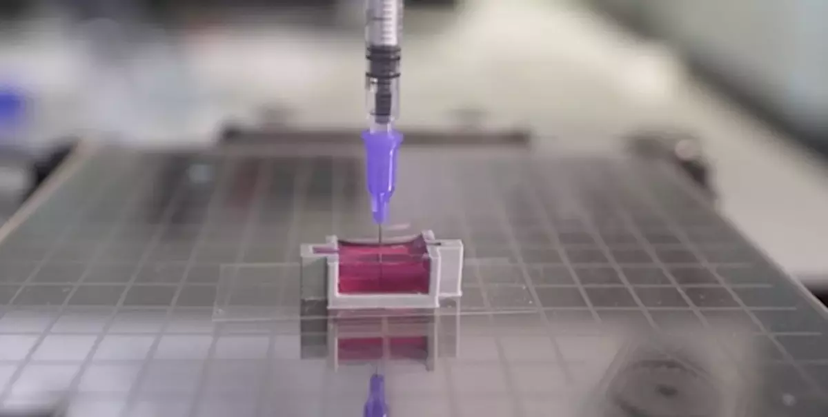 More than a printer: 3D printed ink that heals wounds and changes lives